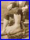 Rare Medical & Anatomical Curiosity Ohio Big Foot Boy Antique Photo Oddities