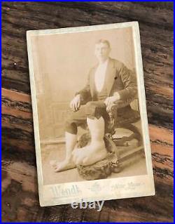 Rare Medical & Anatomical Curiosity Ohio Big Foot Boy Antique Photo Oddities